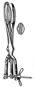 Auvard Zweifel Cranioclast 42cm
