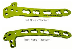 Distal Humerus Safety Lock (LCP) Plate 2.7mm / 3.5mm Dorsolateral With Lateral Support Titanium