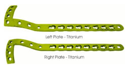 Proximal Tibial Safety Lock (LCP) Plate 3.5mm Titanium